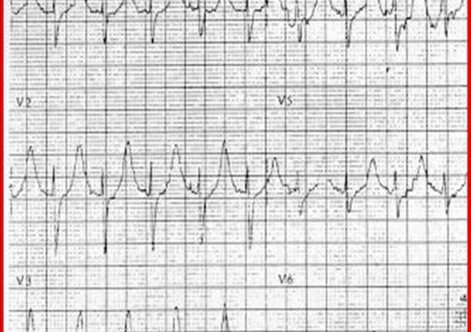 Disaster Life Support: The 21st Century’s CPR